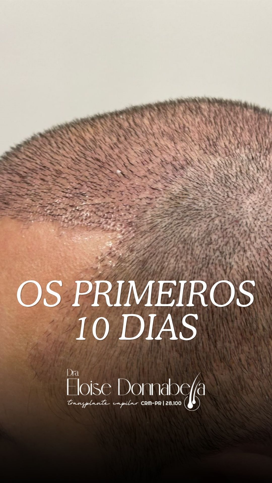 Vídeo: evolução de paciente